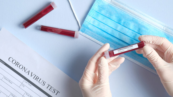 Blutprobe mit Aufschrift Coronavirus-Test wird in den Händen gehalten