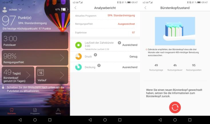 Xiaomi Oclean Z1 smarte Zahnbuerste Langzeittest Erfahrung