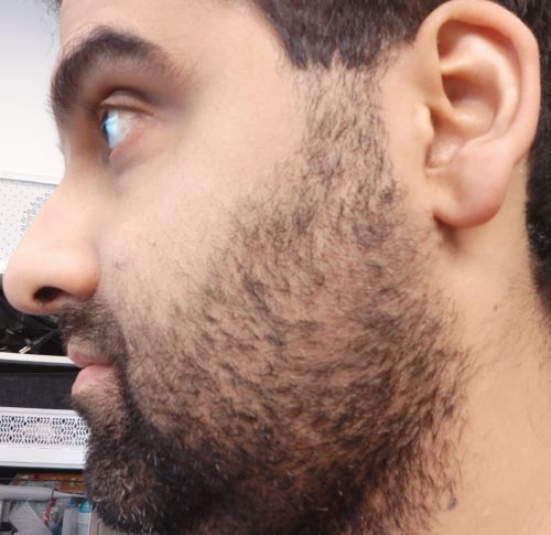 Xiaomi Grooming Kit Pro vorher Seite e1701880182299