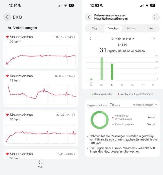 Huawei Watch Fit 5 Pro EKG Arrythmie Messungen Huawei Watch Fit 5 Pro EKG Arrythmie Messungen